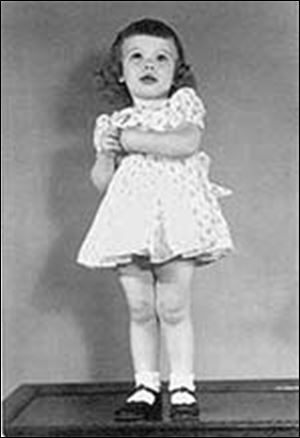 When Gloria Gorka (about 2 years old above) began having difficulty breathing, her parents thought she was just having trouble getting over the measles. But scientists concluded she had contracted beryllium disease, caused by air pollution from a beryllium plant. Gloria died at age 7.