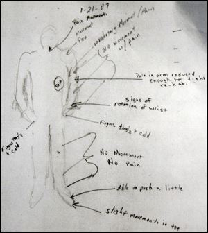 Mrs. Dold says she still has pain and numbness more than a year after surgery, as sketched in the diagram above.