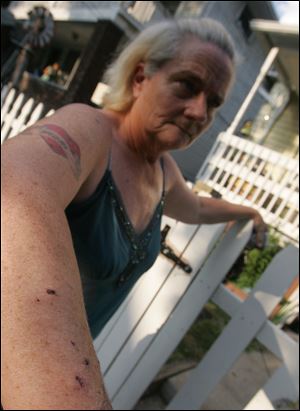 Melinda Perry, Lawrence Mick's girlfriend, says the dog attacked her two weeks ago, biting her arm.