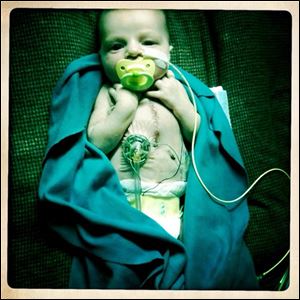 Bowen was born at 7:59 p.m. on Sept. 9 and held briefly by his family before he was whisked away. His heart's left side is underdeveloped. He had surgery less than three days after birth.