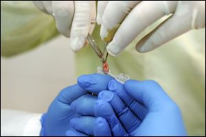 Skin cells removed from the patient are placed in a vial.