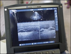 An image from a recent ultrasound performed on Hue, a gibbon at the Toledo Zoo, is seen on a computer screen.
