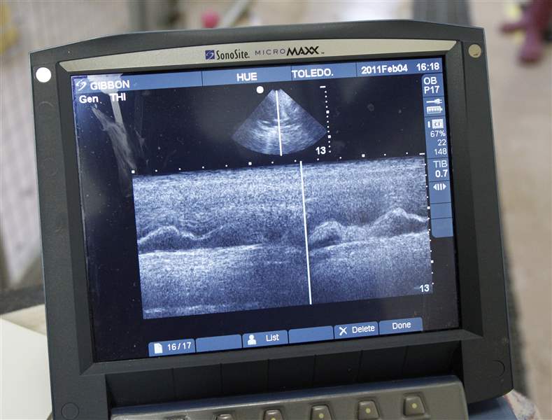 Patients in training: Zoo animals learn to undergo medical procedures