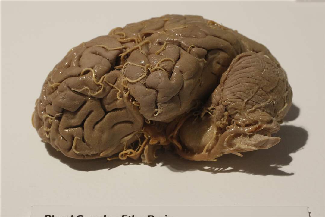 Bodies-Revealed-Exhibit-blood-supply-of-the-brain