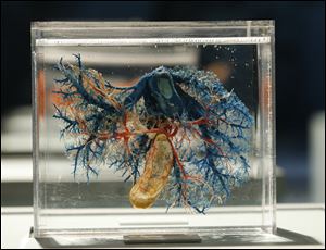 A cross-section shows the blood vessels of the liver.