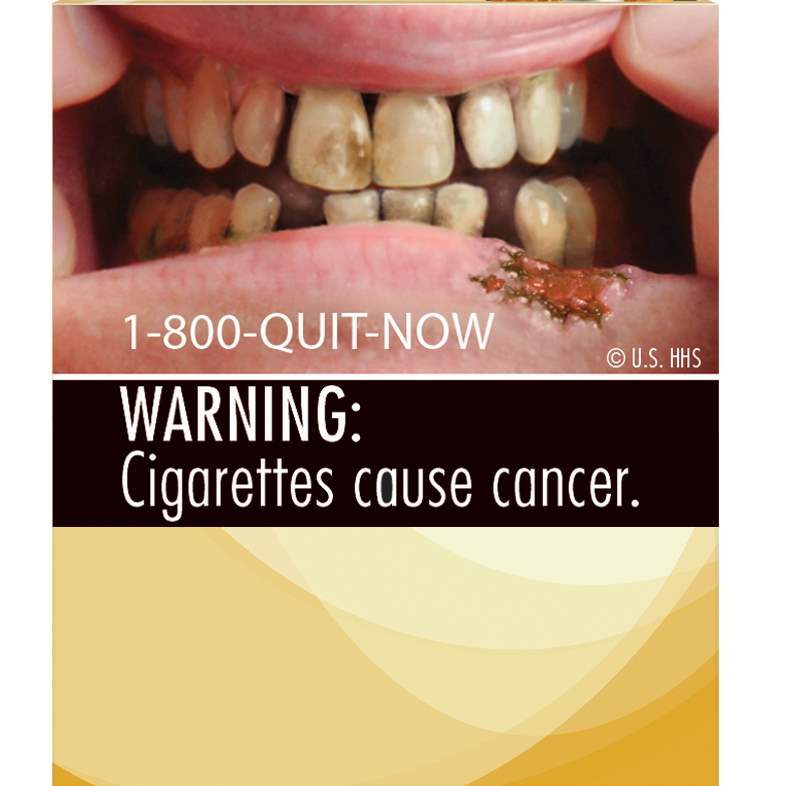FDA-Cigarette-Labels-teeth