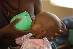 A malnourished child is fed Saturday at a hospital in the border town of Dadaab, Kenya.