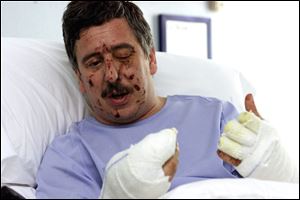 Injured journalist Gorka Landaburu lies in a hospital bed in San Sebastian, Spain, on May 18, 2001, after a letter bomb exploded in his hands. Landaburu, who is Basque, had become the latest victim of ETA, an armed Basque separatist group, because he opposed its violent attacks. Spain passed a tough new law that enabled it to ban political parties that support terrorist acts, collaborate with terrorist groups or refuse to condemn violence. By 2003, the law had already been used to outlaw Basque political party Batasuna that had ties to ETA. Convicted terrorists in Spain face a maximum of 40 years, 10 more than for other crimes, including murder. 