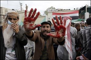 An anti-government protester holds out his blood-stained hands after clashes with security forces, in Sanaa, Yemen. Violence broke out as negotiations were intensifying on a possible political settlement.