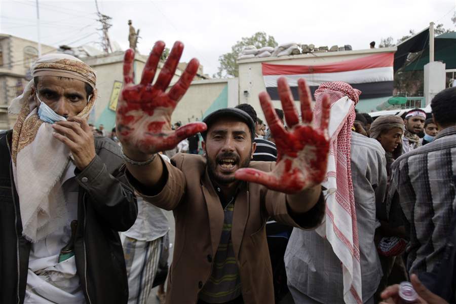 yemeni-protester-holds-up-blood-stained-hands