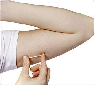 An implant in the arm is the size of a matchstick.