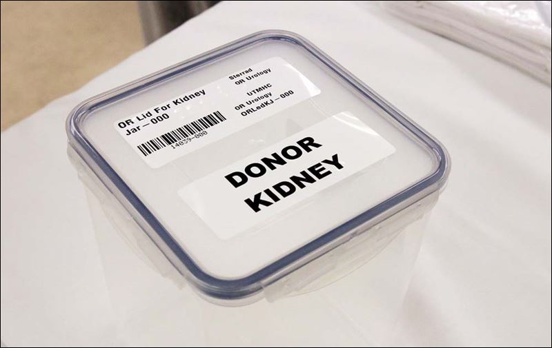 Organ Transplant Program Qualtiy