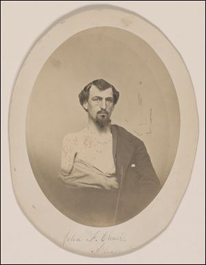 John F. Chase, who lost his right arm and left eye at Gettysburg, which is part of an exhibit at the Library of Congress of letters and diaries saved for 150 years from those who lived through the Civil War that offer a new glimpse at the arguments that split the nation.