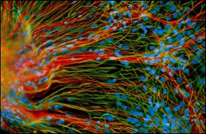 These neural cells started life as embryonic stem cells. Here they generate mature neurons (red) and glial cells (green) in a laboratory at the University of Wisconsin-Madison.