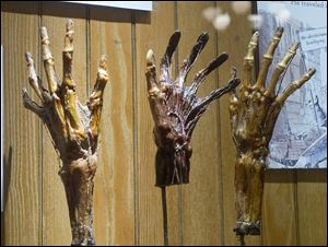 Dried hands are part of the Grimm's Anatomy exhibit at the Mutter Museum of The College of Physicians of Philadelphia. ‘We don't sugarcoat or glorify anything,’ says curator Anna Dhody. 