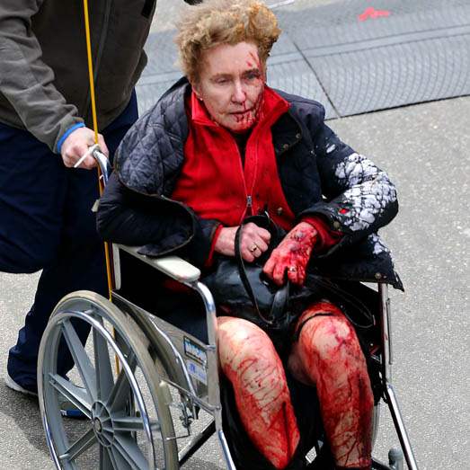Boston-Marathon-Explosions-injured-woman