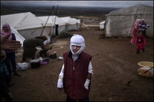 Abdullah Ahmed, 10, who suffered burns in a Syrian government airstrike and fled his home with his family, stands outside their tent at a camp for displaced Syrians in the village of Atmeh, Syria, December, 2012. This image was one in a series of 20 by AP photographers that won the 2013 Pulitzer Prize in Breaking News Photography. 