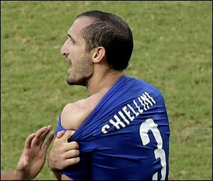 Italy's Giorgio Chiellini displays his shoulder showing apparent teeth marks after colliding with the mouth of Uruguay's Luis Suarez during the group D World Cup soccer match in Natal, Brazil today.