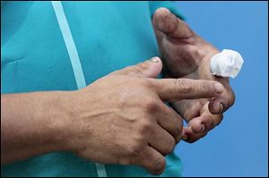 An on-the-job accident resulted in the amputation of part of Garcia's left index finger. 