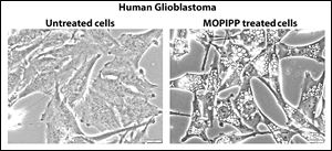 Researches found that cells treated with a unique chemical produced many more exosomes.