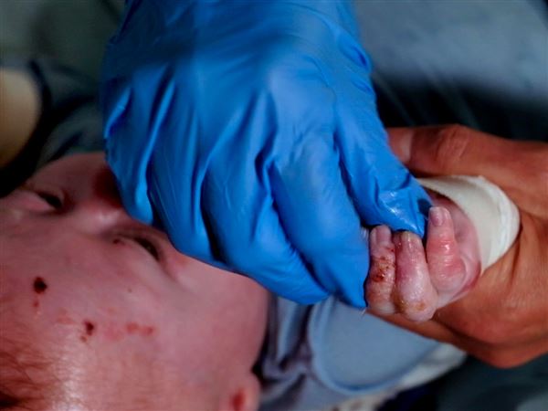 Life with Archer: Local family rallies around son with rare disease