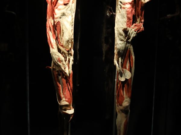 'Body Worlds Rx' opens at Imagination Station