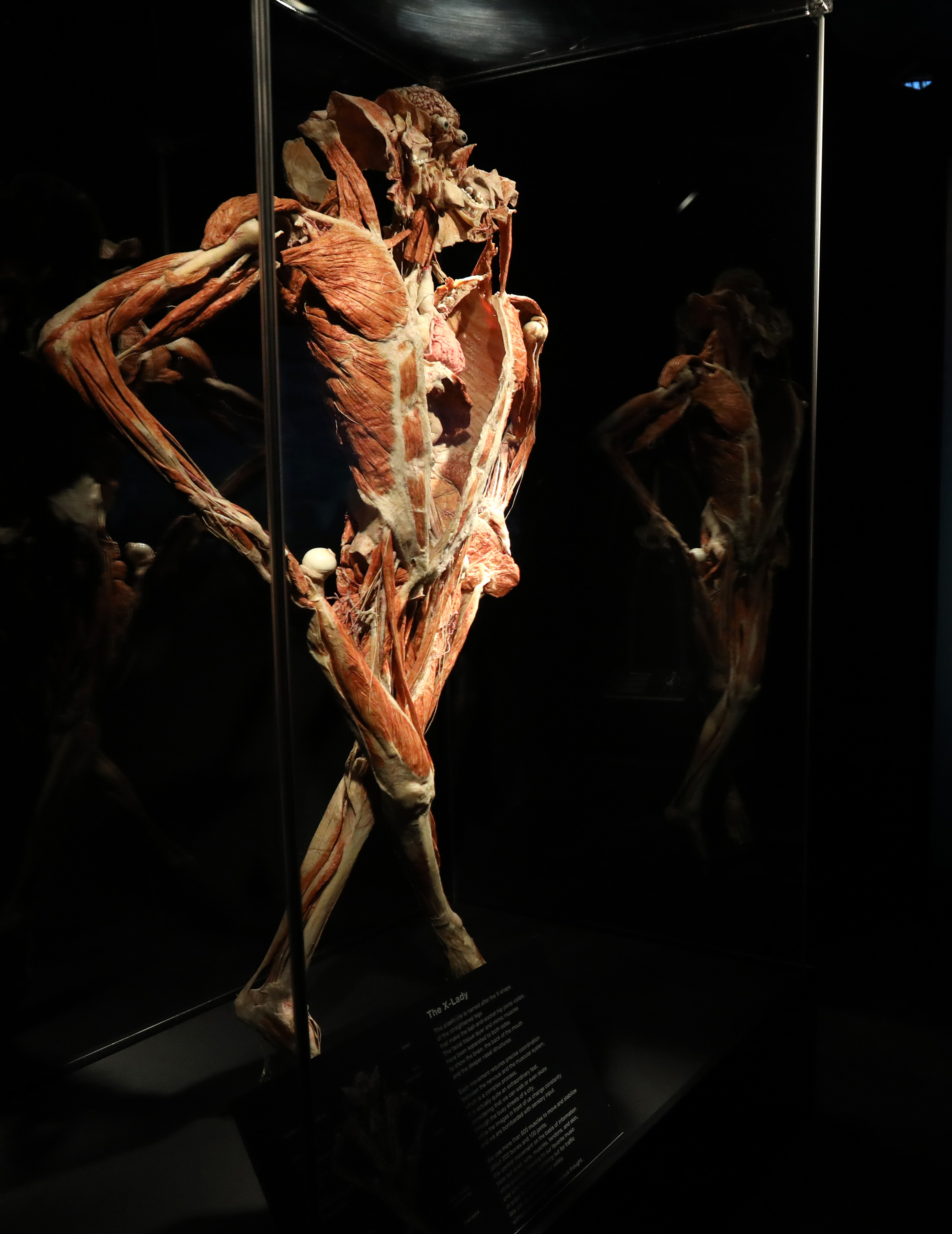 'Body Worlds Rx' opens at Imagination Station - The Blade