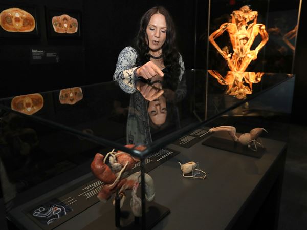 What lies beneath: Exhibit gives realistic look at human body
