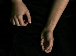 Scars from self-inflicted wounds mark the lower arm of Ruthanna Clinger, who began cutting herself a few years ago but has since stopped. 'I want a lot more than cutting myself for the rest of my life,' she says.