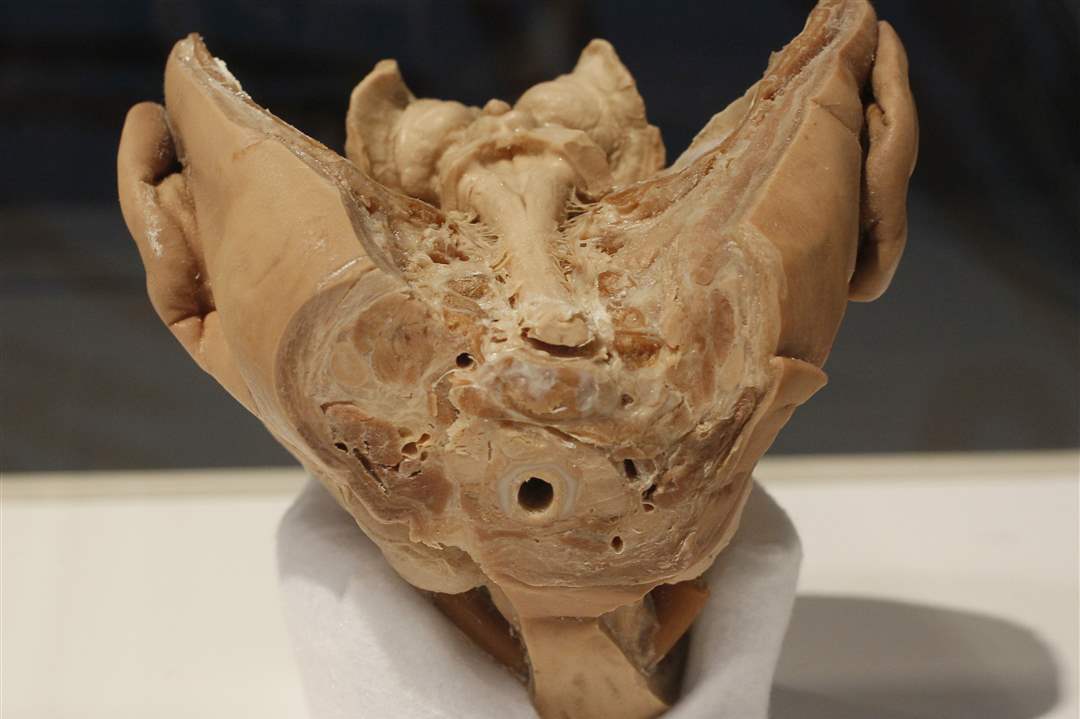 Bodies-Revealed-Exhibit-crainial-nerves