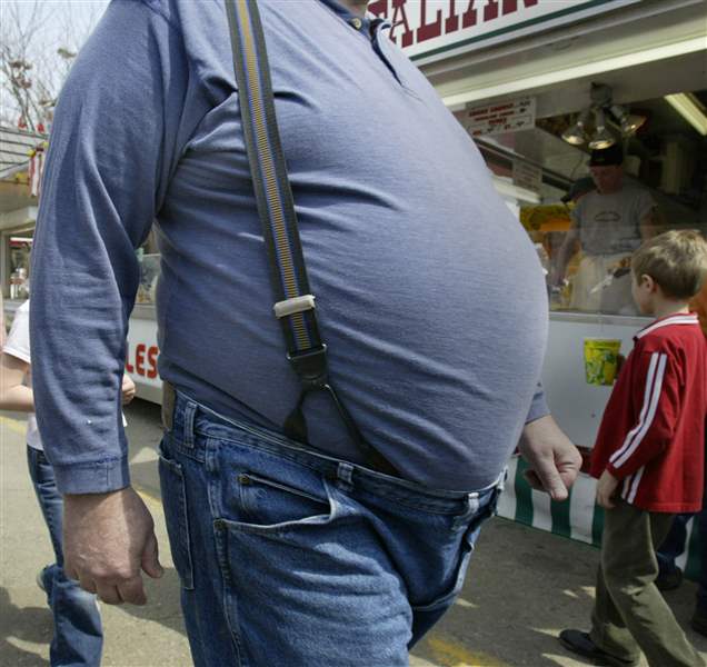 Obesity