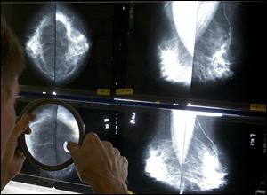 A radiologist uses a magnifying glass to check mammograms for breast cancer in Los Angeles. 