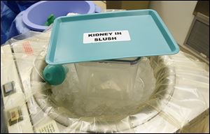 A labeled container and cover will now be used during kidney transplants.