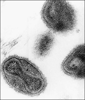 This 1975 file electronmicrograph from the Centers for Disease Control shows the smallpox virus. 