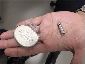 Dr. Kamala Tamirisa shows the difference in size of a traditional pacemaker, left, and a new leadless pacemaker.