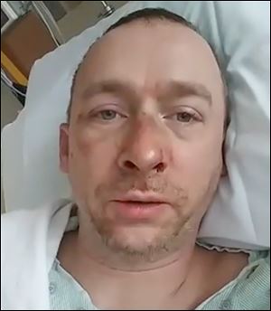 Thomas Wilcox, 45, said he was robbed and attacked on Dec. 22 as he was leaving Bretz nightclub. Mr. Wilcox said he remembers being called a homophobic slur as he was being attacked.