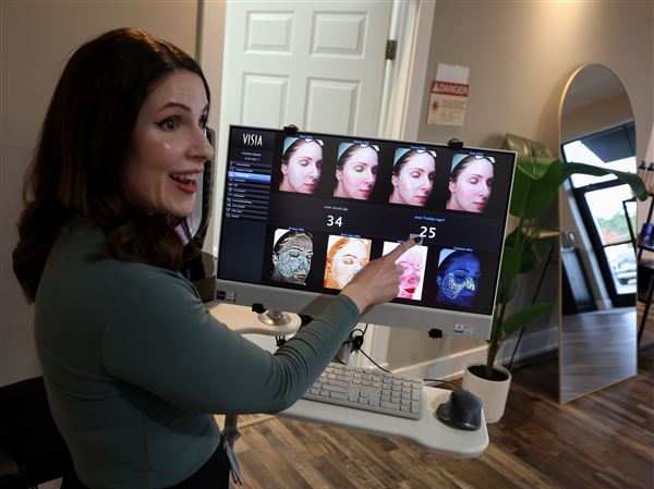 Acne treatment boosts confidence and healing
