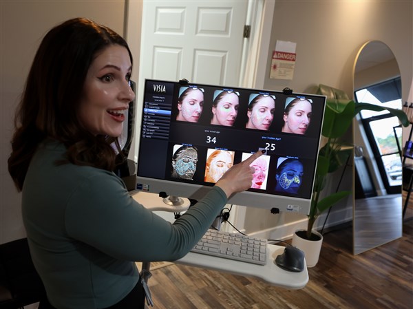 Acne treatment boosts confidence and healing