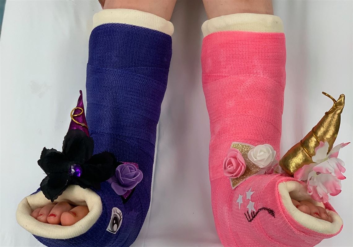 Casts have evolved over the years, and can be as unique as you are | The  Blade