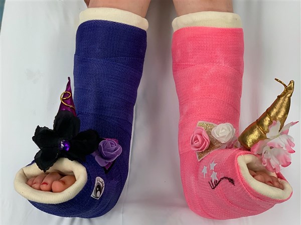 Casts have evolved over the years, and can be as unique as you are