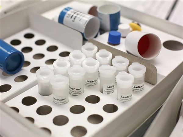 Little to no lead found in Fulton County blood tests