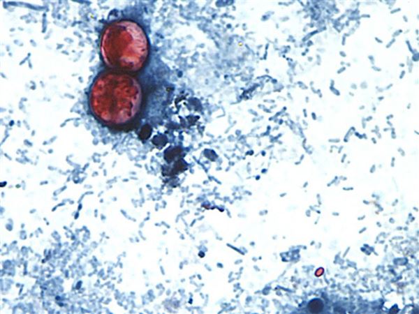 Michigan says cyclosporiasis outbreak may be linked to lettuce and salad greens
