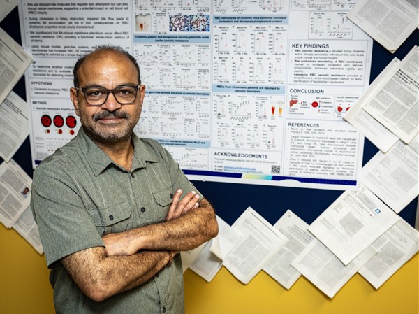 UT researchers discover hidden marker for liver disease